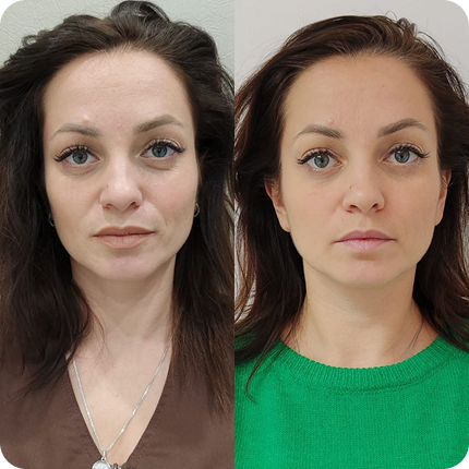 Результат после сеанса