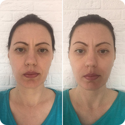 Результат после сеанса