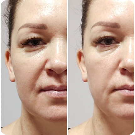 Результат после сеанса