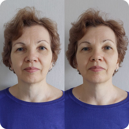 Результат после сеанса