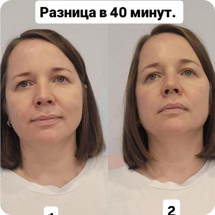 Результат после сеанса